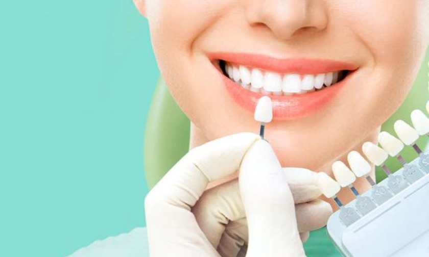 Tips To Choose The Best Dentist For Veneer Teeth Removal