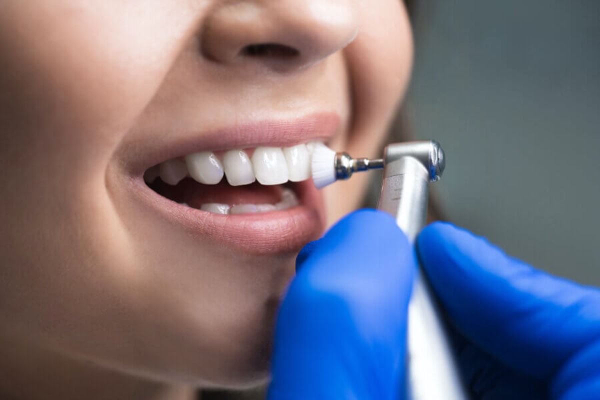 How Often Should You Schedule Teeth Cleanings?